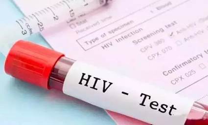hiv test